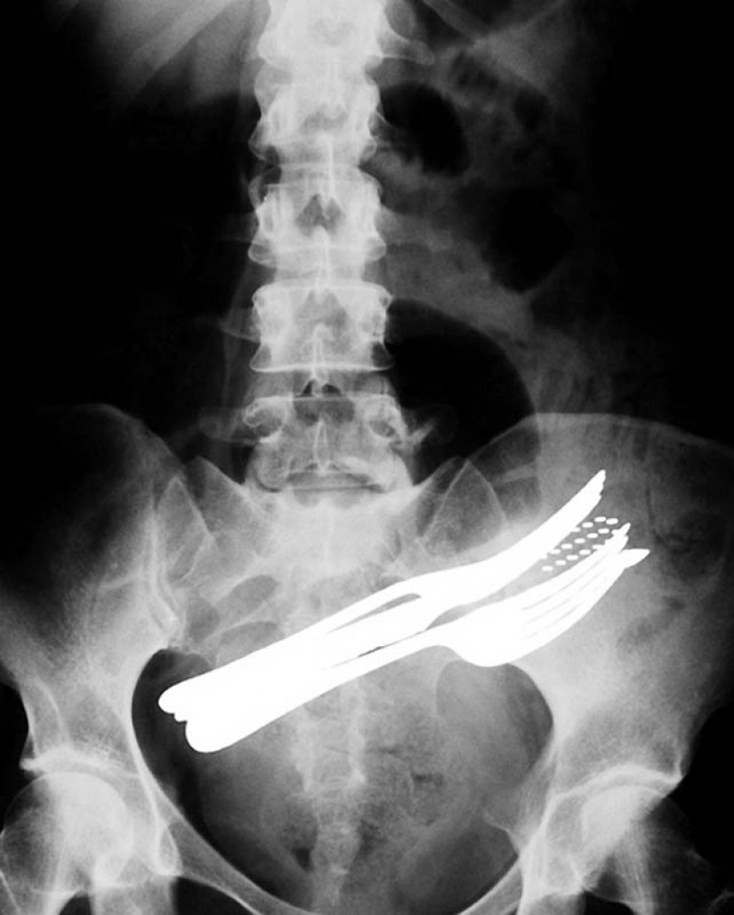 The most bizarre x-rays