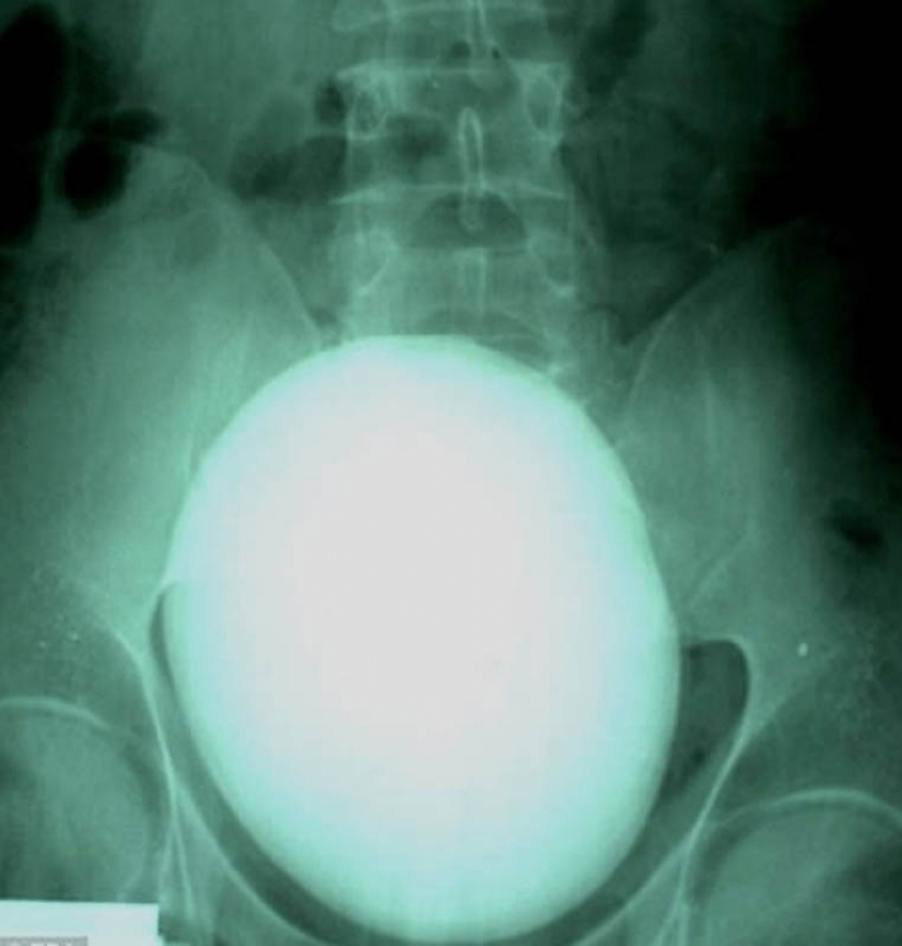 The most bizarre x-rays