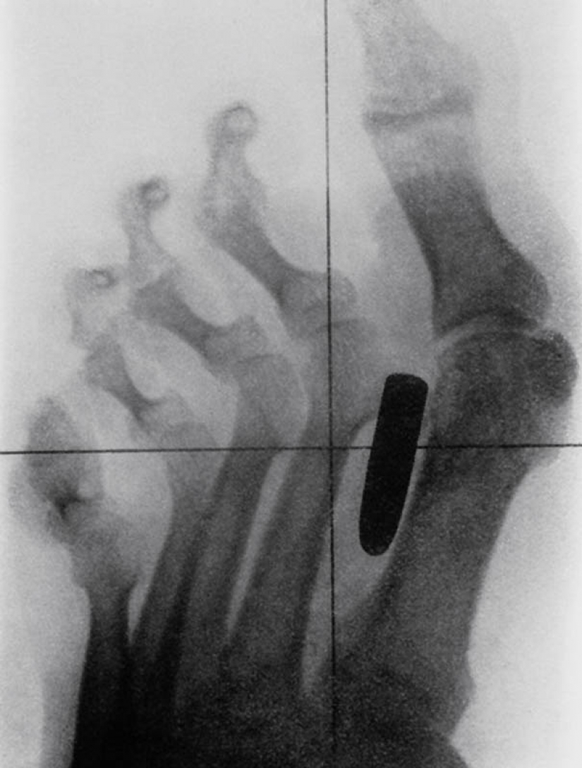 The most bizarre x-rays