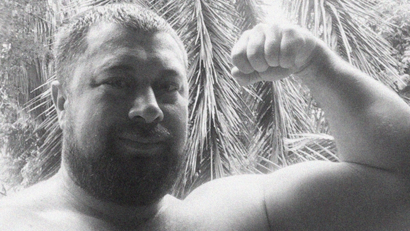 The wife asked her husband to stop snoring, he went to Moscow and died there after rhinoplasty at a discount The wife asked her husband to stop snoring, he went to Moscow and died there after rhinoplasty at a discount