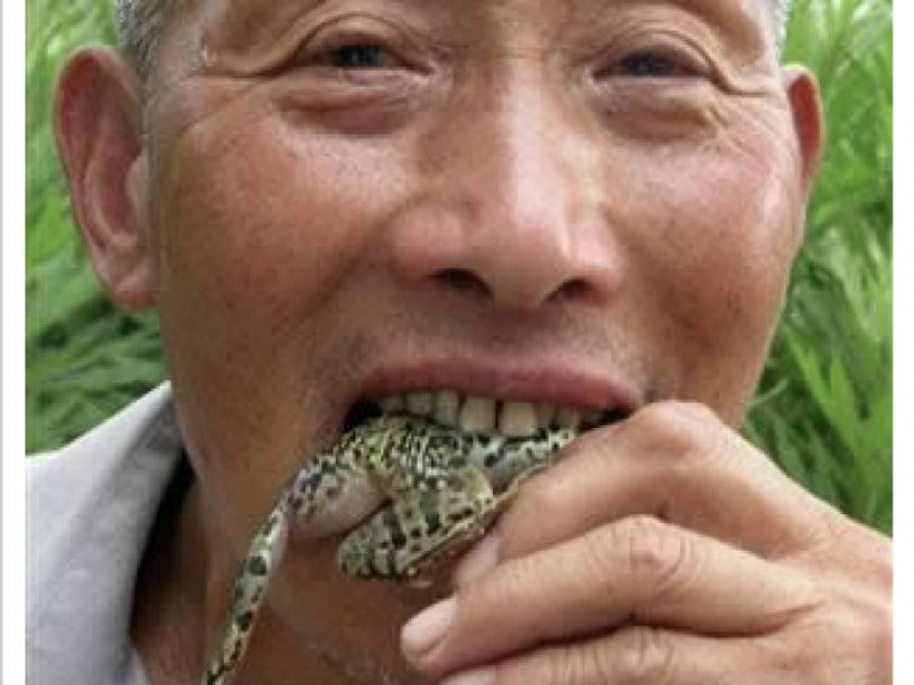 The worst items that have ever found in a human stomach