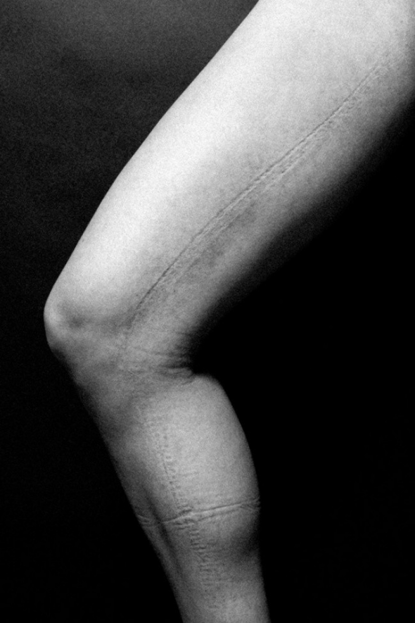 This is what lies behind the female splendor. On these photos even it is painful to watch