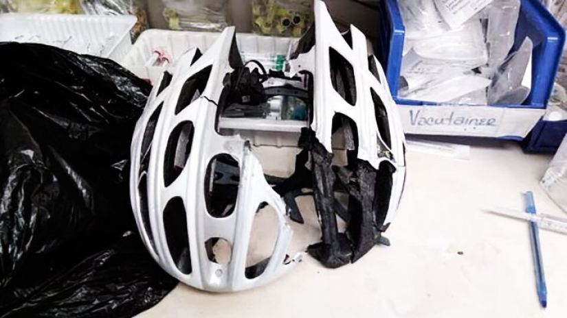 Watch your head: victims in accidents shared the photos of helmets that saved their lives Watch your head: victims in accidents shared the photos of helmets that saved their lives