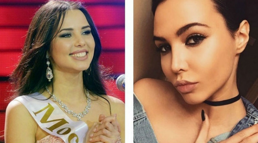 10 bellezas rusas antes y después de la cirugía plástica