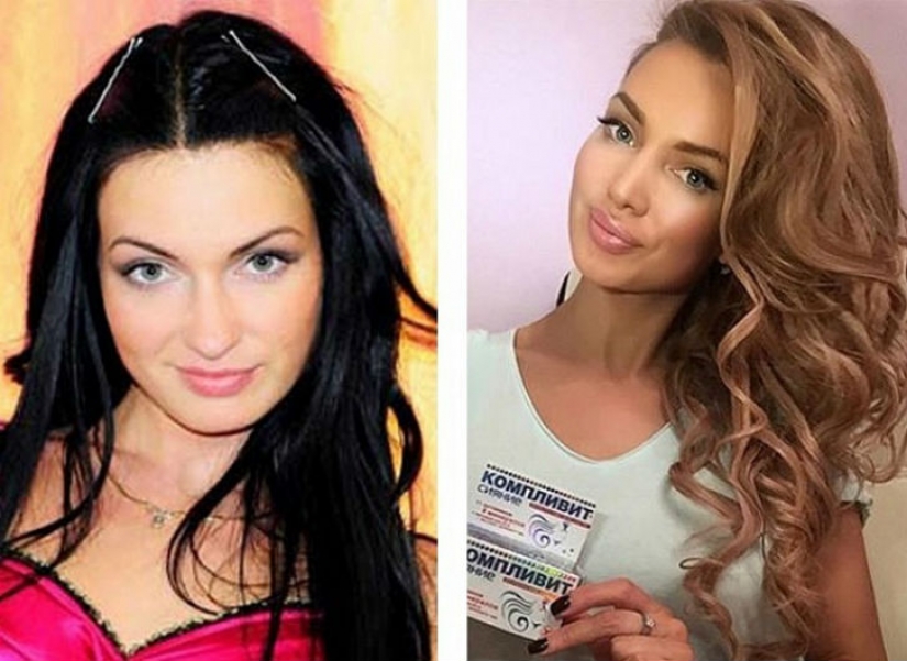 10 bellezas rusas antes y después de la cirugía plástica