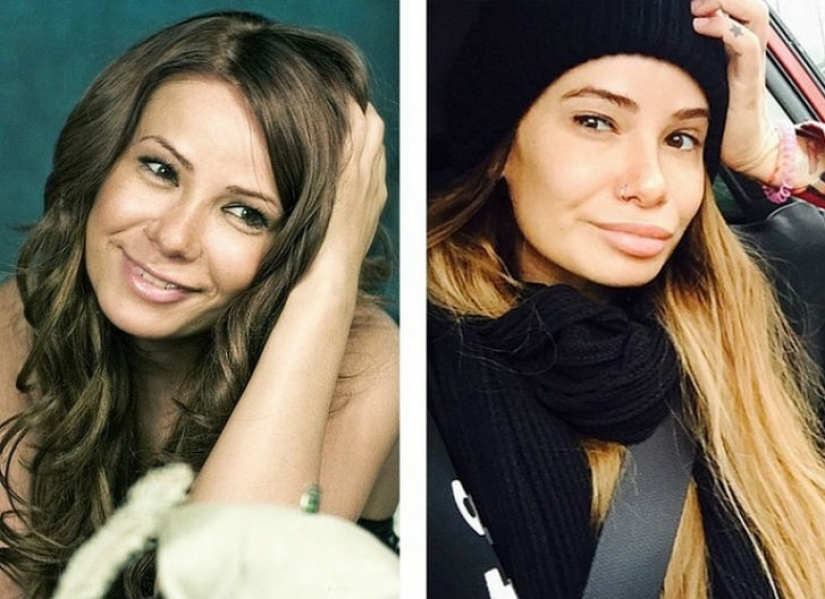 10 bellezas rusas antes y después de la cirugía plástica