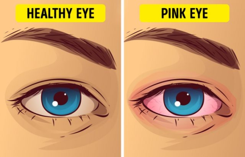 10 causas de discapacidad visual repentina