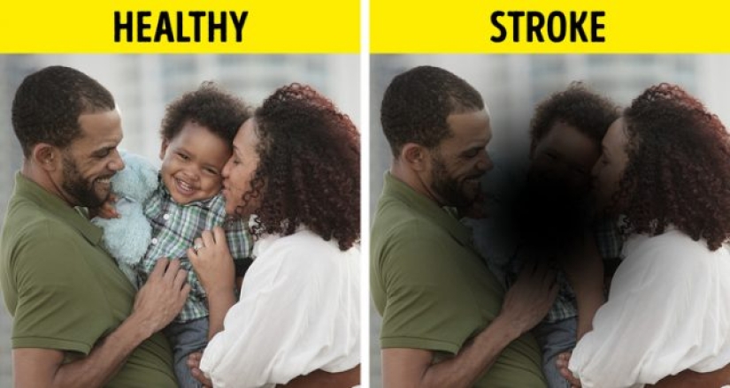 10 causas de discapacidad visual repentina