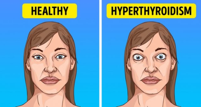 10 causes of sudden visual impairment