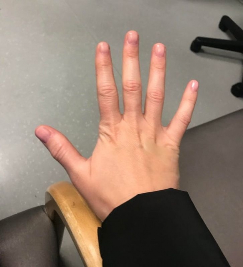 10 coincidencias al azar