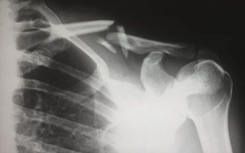 10 disturbing facts you probably shouldn't have shared