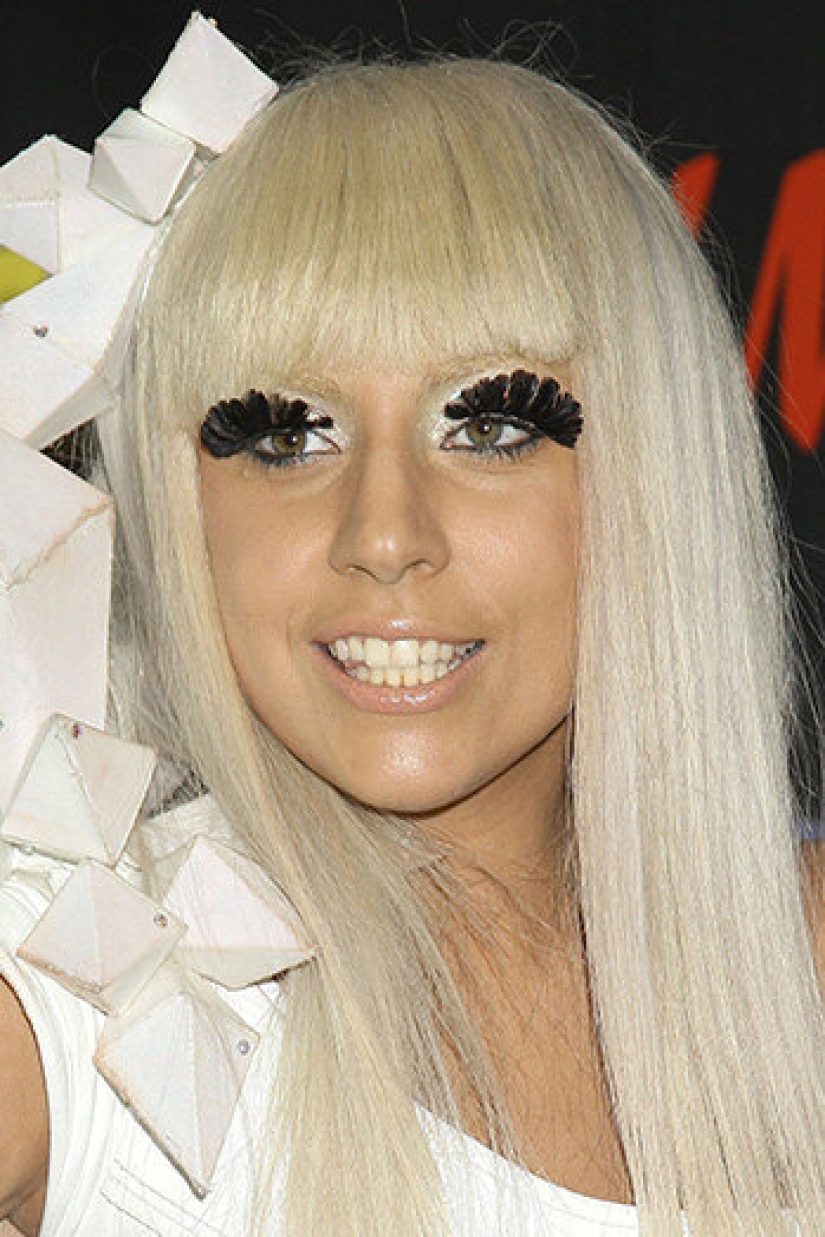 10 estrellas que han tenido cirugía plástica de mentón