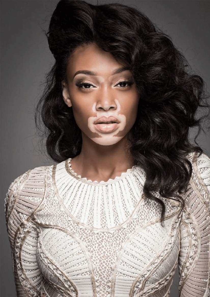 10 incredible beauties with unique appearance