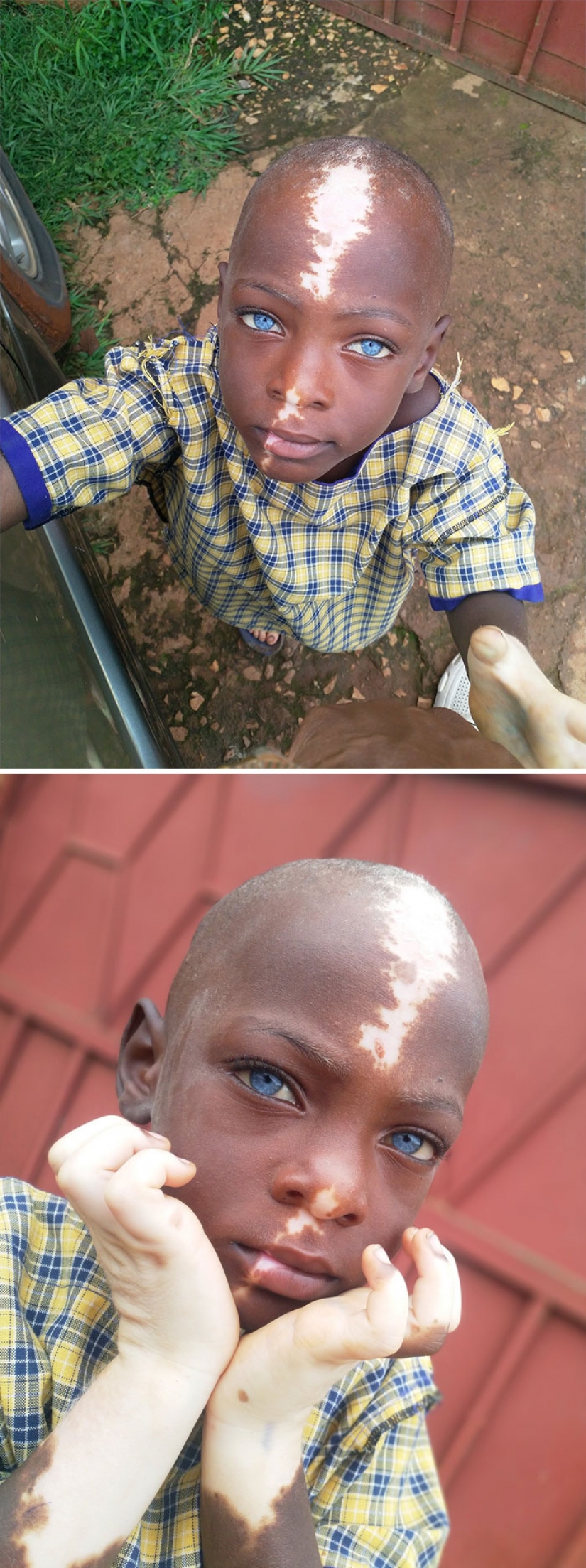 10 personas cuya genética los hizo únicos