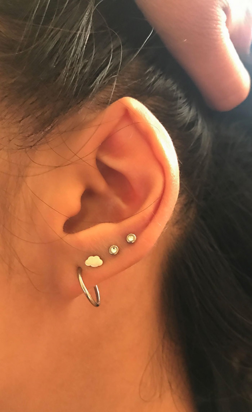 10 personas cuya genética los hizo únicos