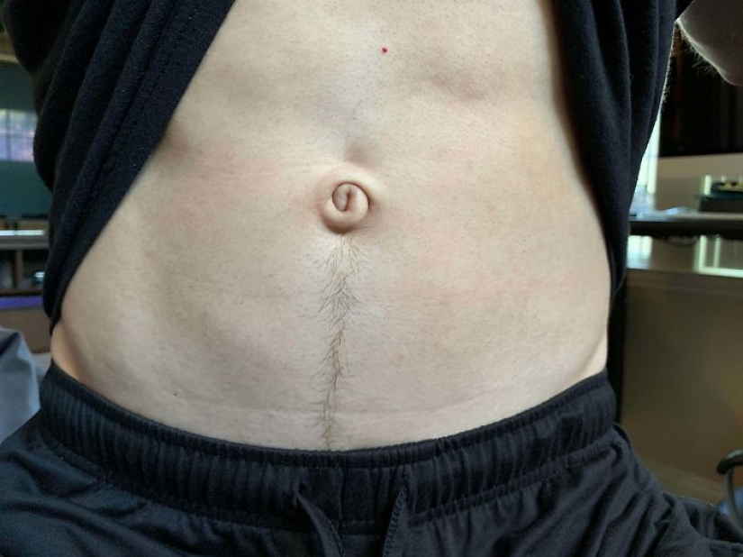 10 personas cuya genética los hizo únicos