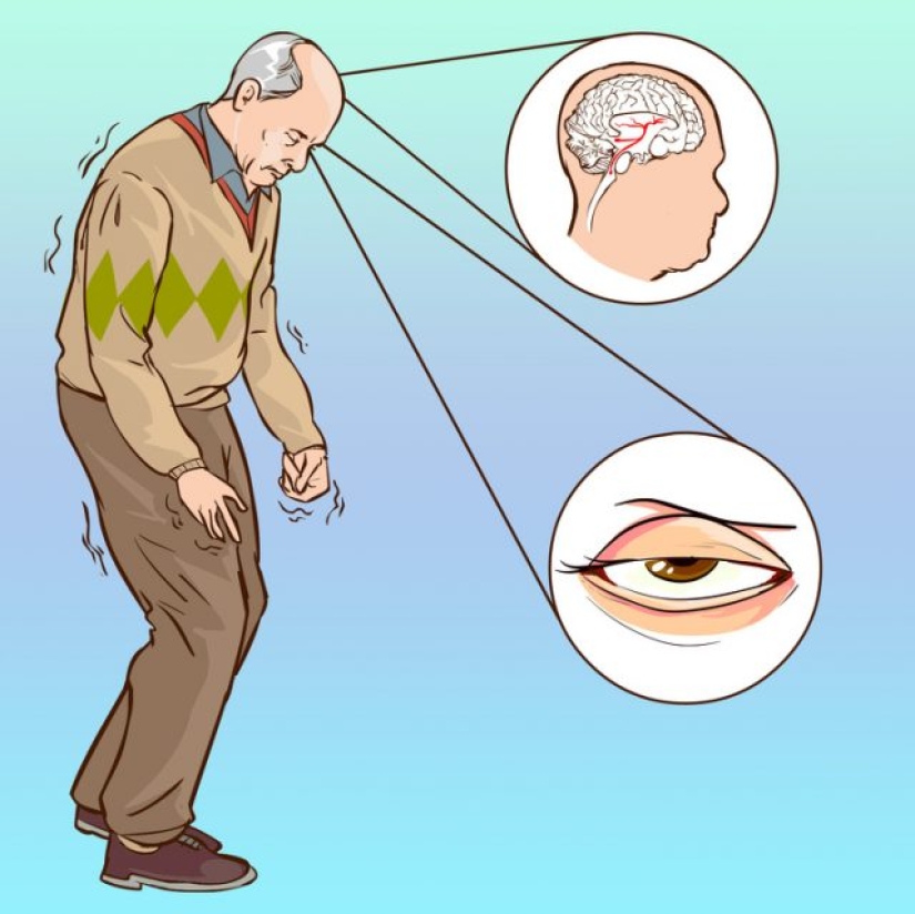 10 razones de la pérdida repentina de la visión