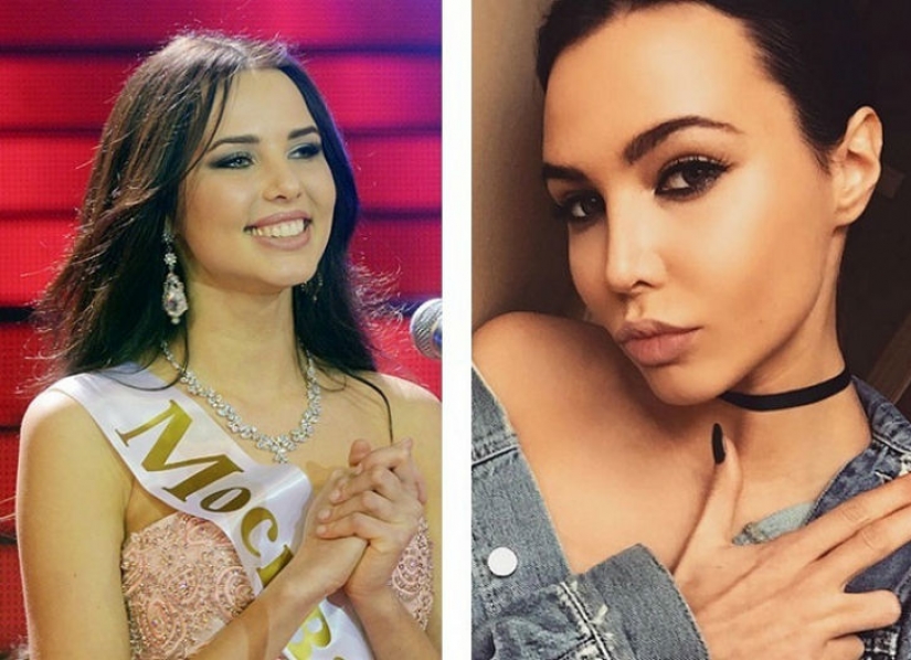 10 Russian beauties before and after plastic surgery
