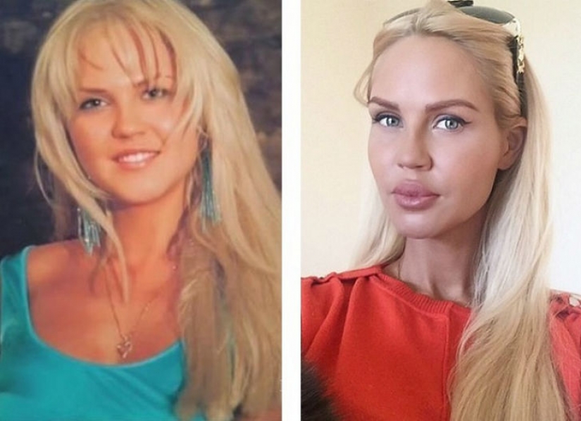10 Russian beauties before and after plastic surgery