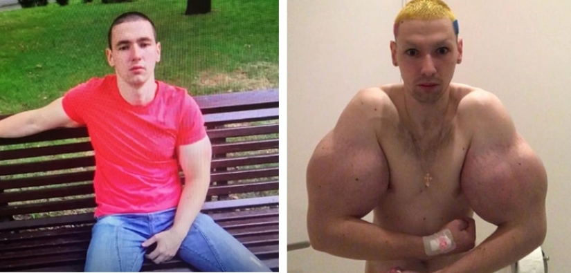 10 Russian freaks before and after transformation 10 Russian freaks before and after transformation