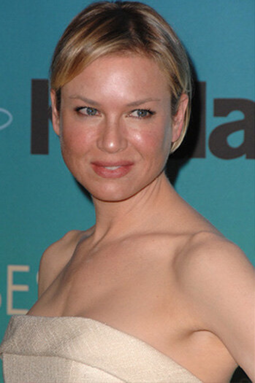 10 stars who have had chin plastic surgery 10 stars who have had chin plastic surgery