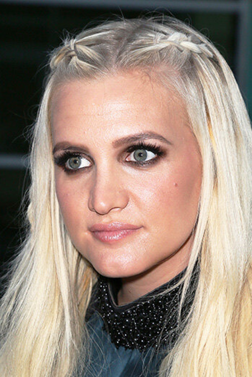 10 stars who have had chin plastic surgery 10 stars who have had chin plastic surgery