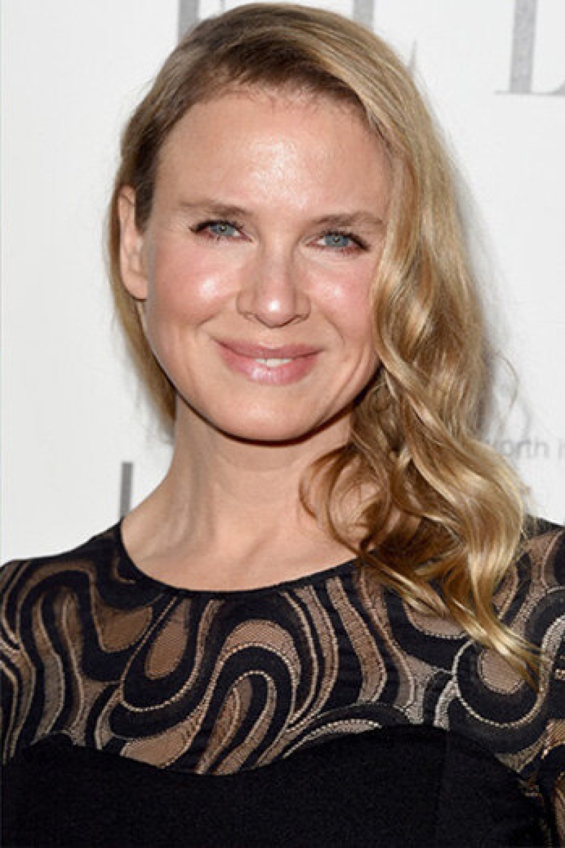 10 stars who have had chin plastic surgery 10 stars who have had chin plastic surgery