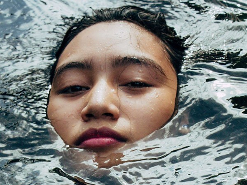 10 strangest types of allergies