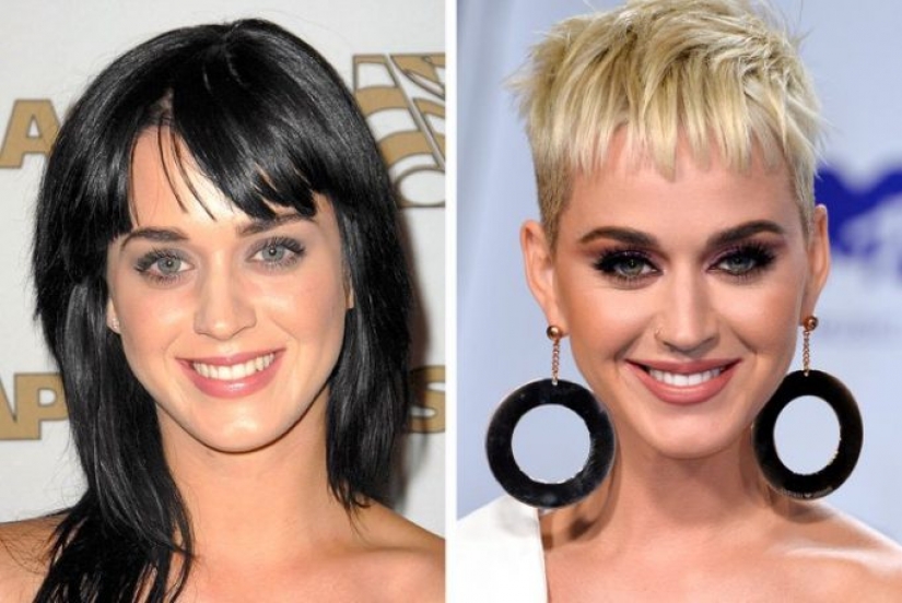 11 celebridades que revelaron con orgullo que se sometieron a una cirugía estética y no se arrepintieron