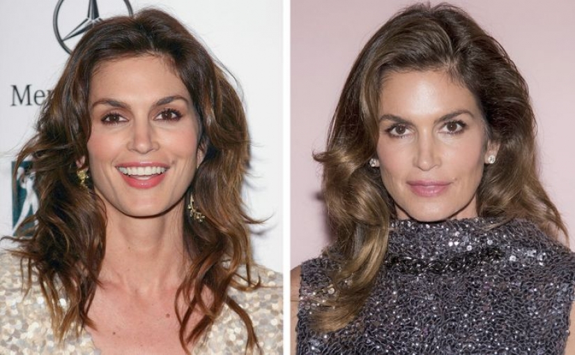 11 celebrities who proudly revealed they had cosmetic surgery and didn't regret it