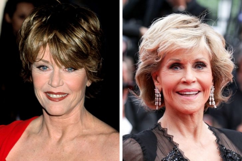 11 celebrities who proudly revealed they had cosmetic surgery and didn't regret it