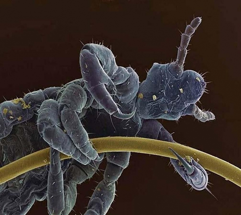 15 amazing creatures which can't see without a microscope 15 amazing creatures which can't see without a microscope