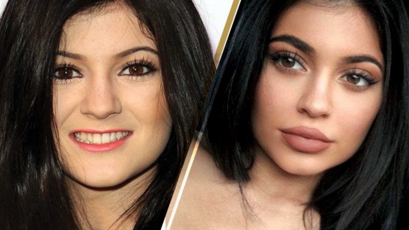 15 celebrities who has changed most over the last decade 15 celebrities who has changed most over the last decade