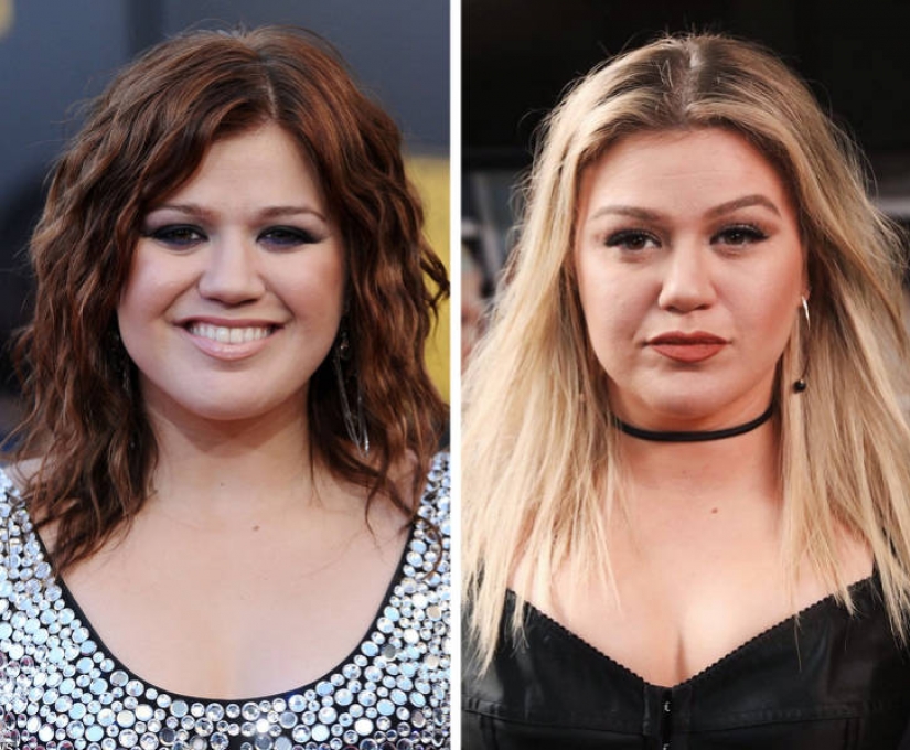 15 celebrities who has changed most over the last decade 15 celebrities who has changed most over the last decade