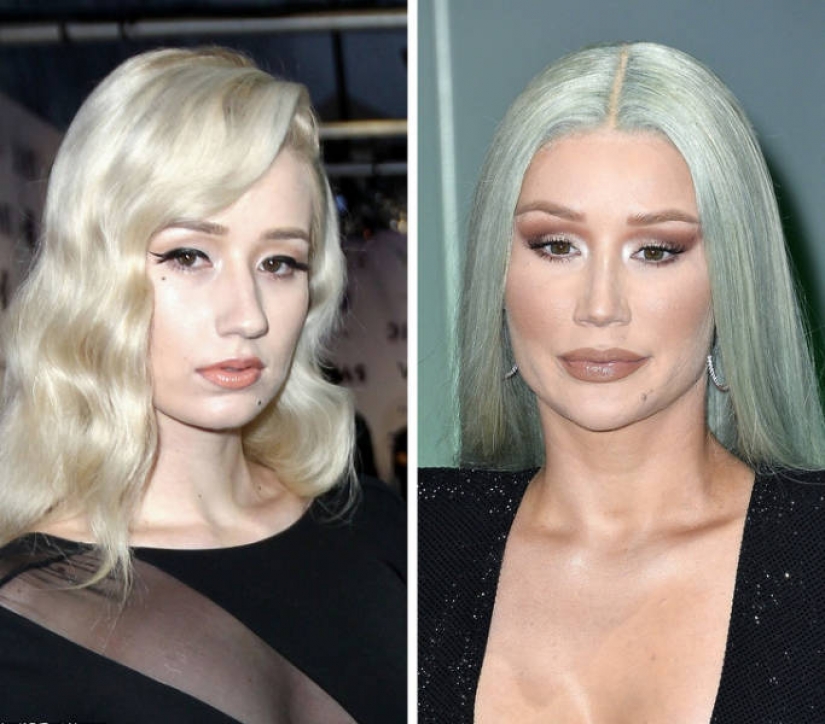 15 celebrities who has changed most over the last decade 15 celebrities who has changed most over the last decade