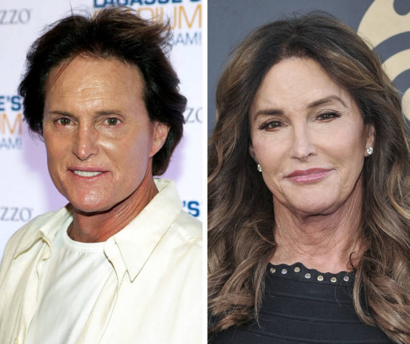 15 celebrities who has changed most over the last decade 15 celebrities who has changed most over the last decade