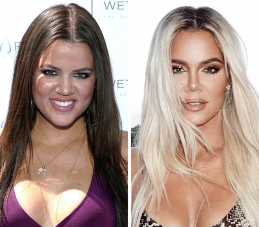 15 celebrities who has changed most over the last decade 15 celebrities who has changed most over the last decade