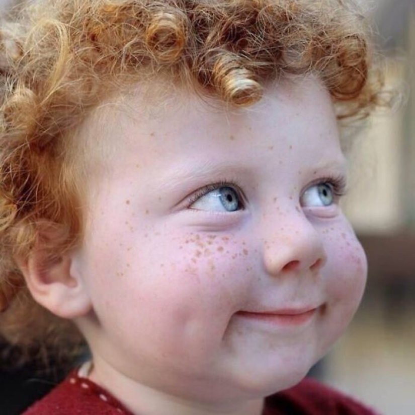 16 fascinating photos of people with freckles