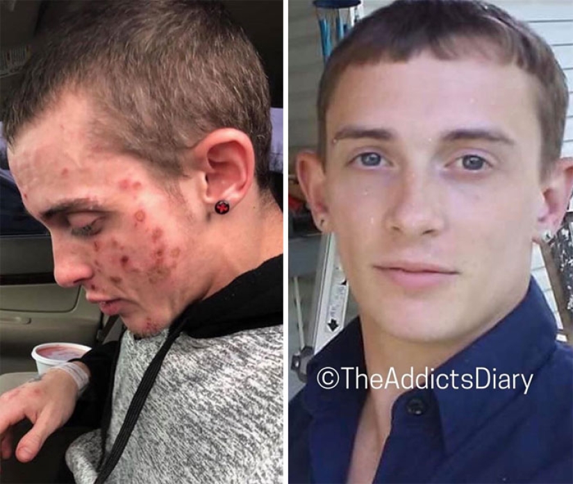 25 photos of people before and after overcoming addiction 25 photos of people before and after overcoming addiction