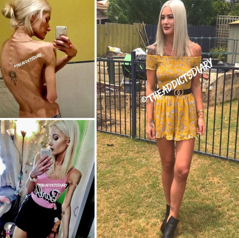 25 photos of people before and after overcoming addiction 25 photos of people before and after overcoming addiction