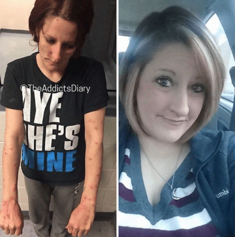 25 photos of people before and after overcoming addiction 25 photos of people before and after overcoming addiction
