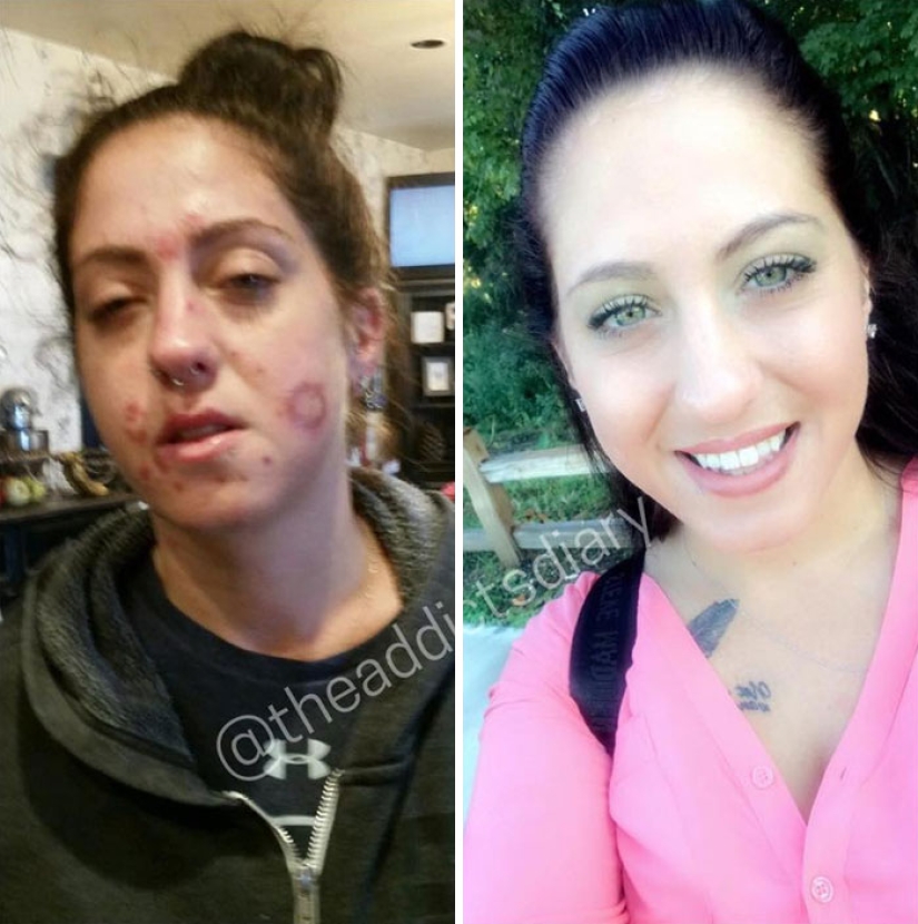 25 photos of people before and after overcoming addiction 25 photos of people before and after overcoming addiction