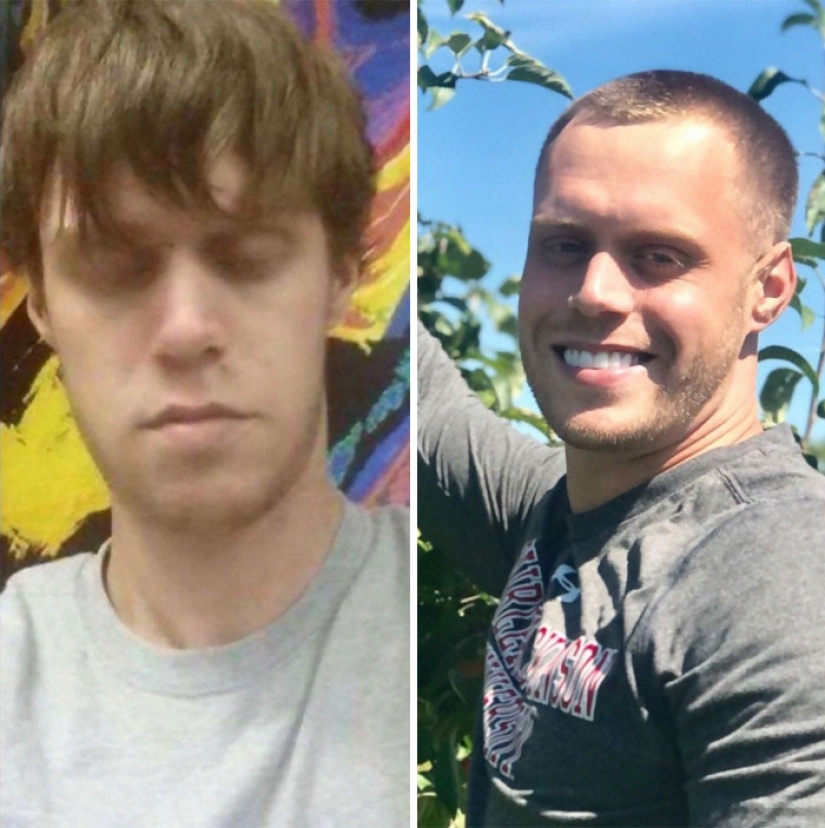 25 photos of people before and after overcoming addiction 25 photos of people before and after overcoming addiction