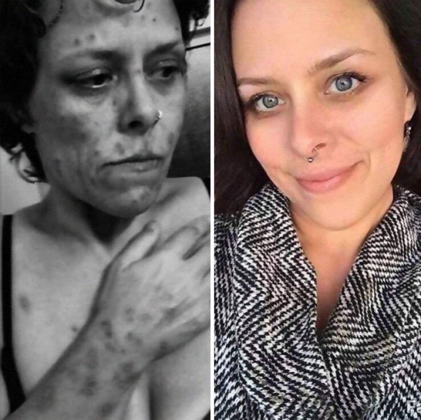 25 photos of people before and after overcoming addiction 25 photos of people before and after overcoming addiction