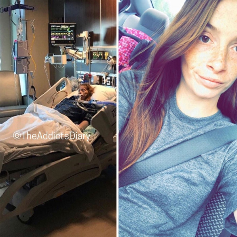 25 photos of people before and after overcoming addiction 25 photos of people before and after overcoming addiction