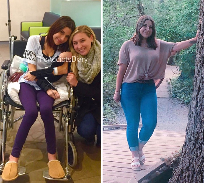 25 photos of people before and after overcoming addiction 25 photos of people before and after overcoming addiction