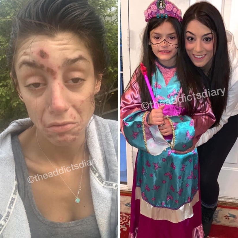 25 photos of people before and after overcoming addiction 25 photos of people before and after overcoming addiction