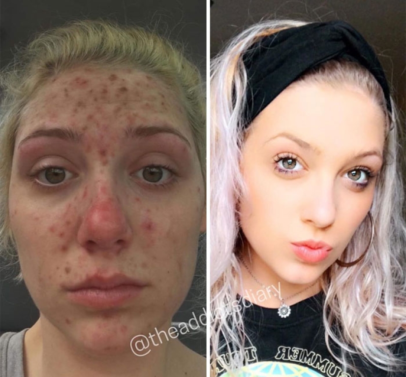 25 photos of people before and after overcoming addiction 25 photos of people before and after overcoming addiction