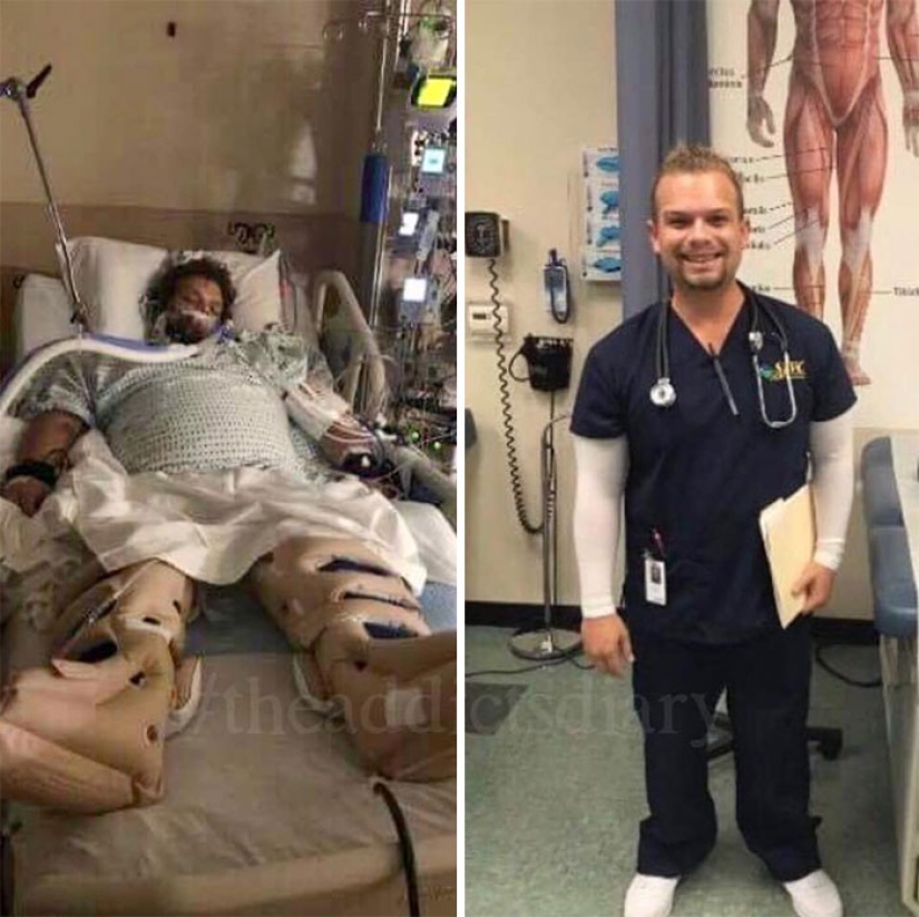 25 photos of people before and after overcoming addiction 25 photos of people before and after overcoming addiction