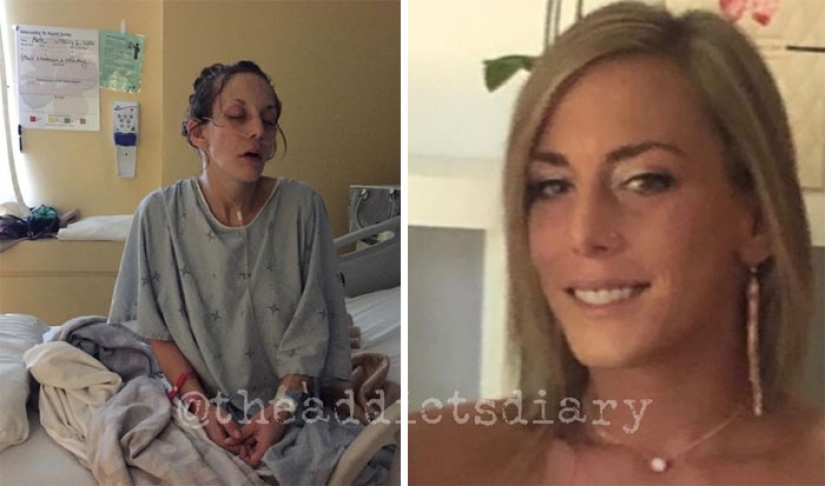 25 photos of people before and after overcoming addiction 25 photos of people before and after overcoming addiction